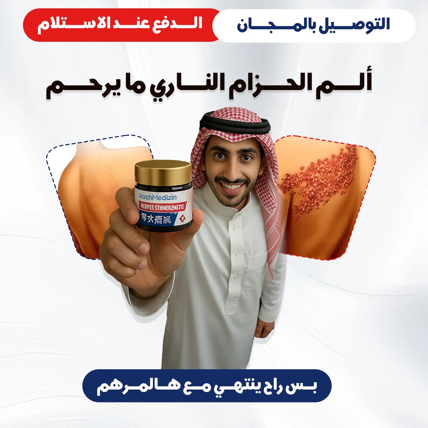 مرهم علاج الحزام الناري والندبات